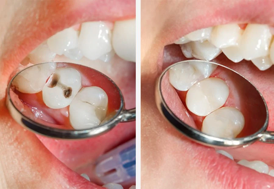 Restorative Dentistry